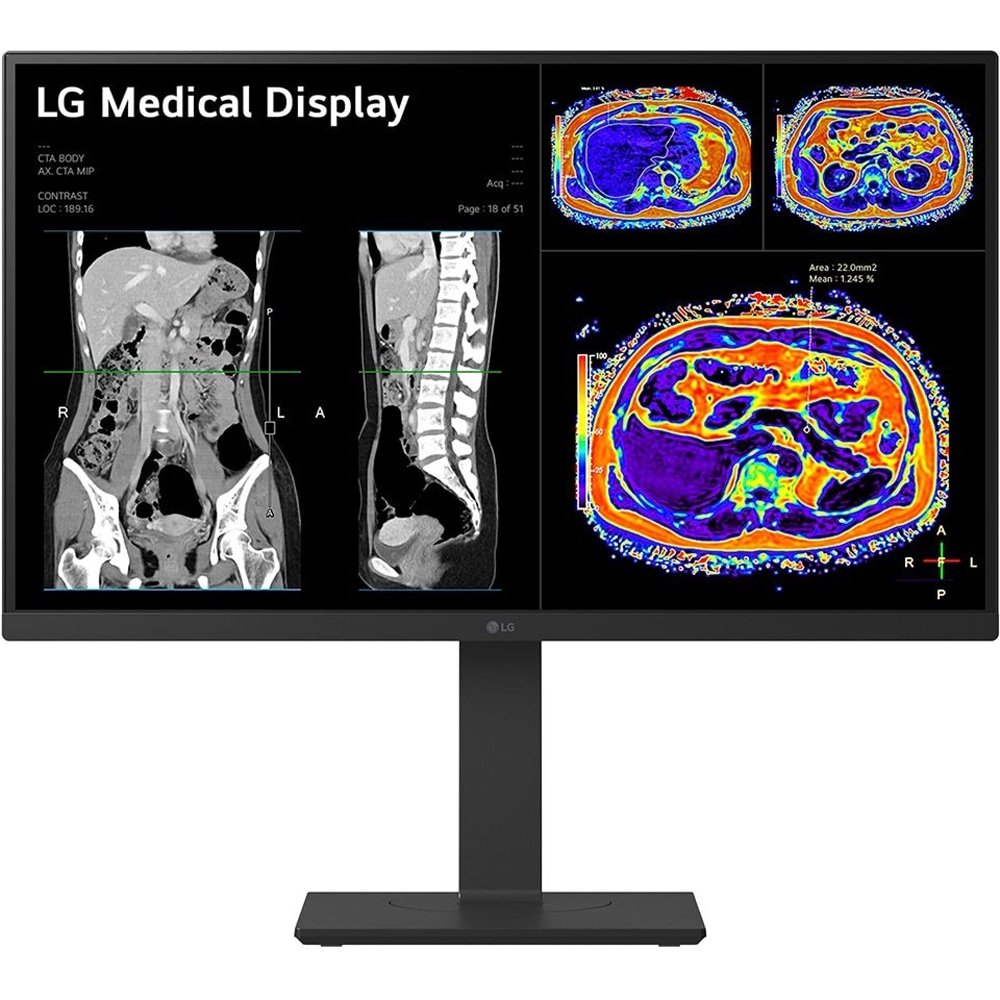 Monitor medical profesional LED IPS LG 27HS713C, 27", 4K 8MP, 60Hz, Brightness Stabilization, negru