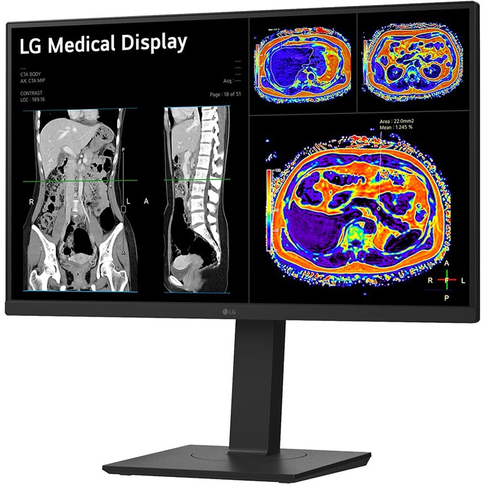 Monitor medical profesional LED IPS LG 27HS713C, 27", 4K 8MP, 60Hz, Brightness Stabilization, negru