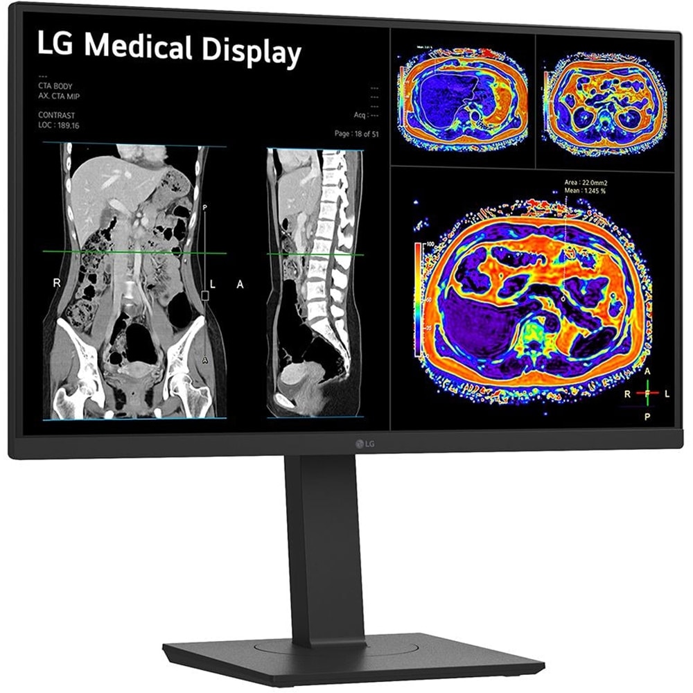 Monitor medical profesional LED IPS LG 27HS713C, 27", 4K 8MP, 60Hz, Brightness Stabilization, negru