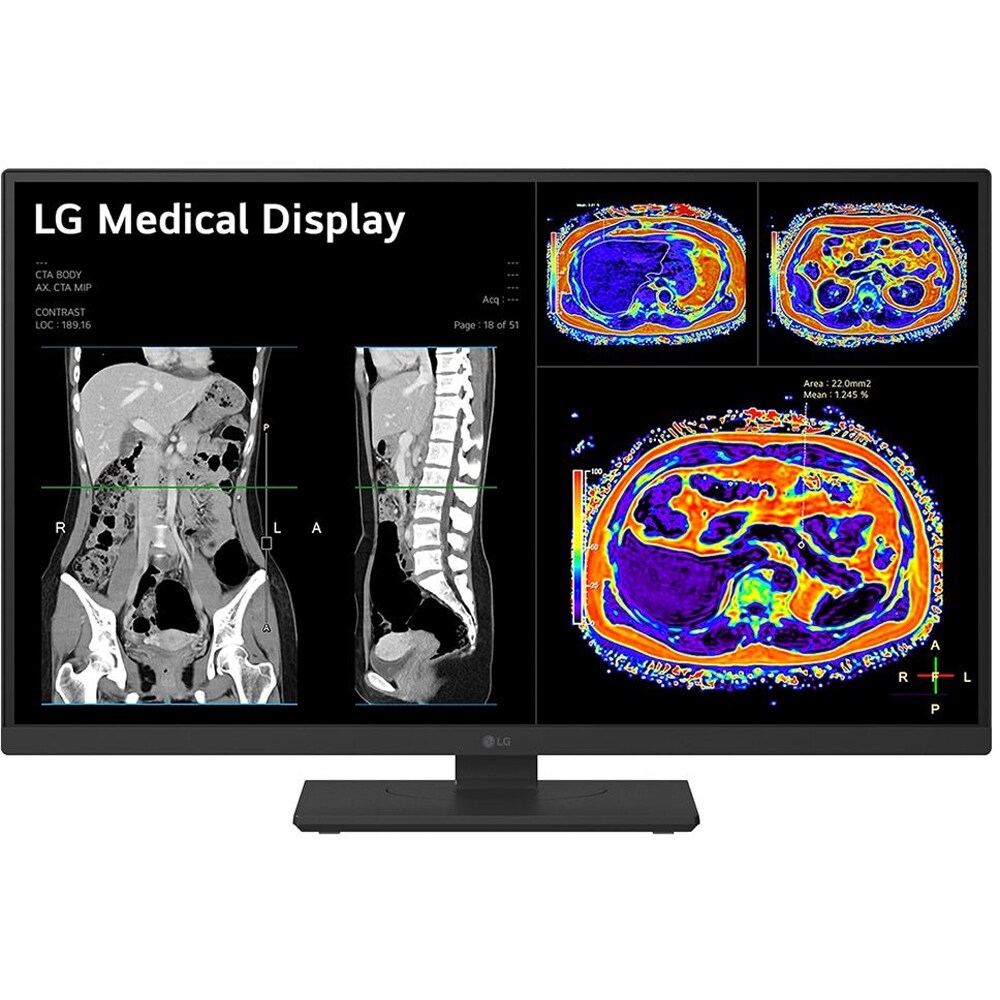 Monitor medical profesional LED IPS LG 27HS713C, 27", 4K 8MP, 60Hz, Brightness Stabilization, negru