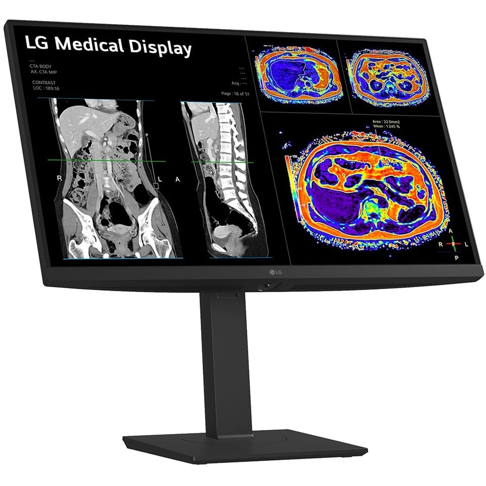 Monitor medical profesional LED IPS LG 27HS713C, 27", 4K 8MP, 60Hz, Brightness Stabilization, negru