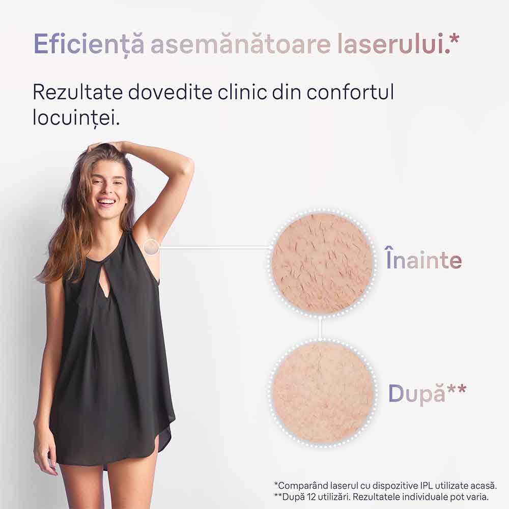 Epilator IPL BRAUN Skin i-Expert Pro 7 PL7147, 400000 impulsuri, 10 viteze, 3 accesorii, SkinPro 2.0, reatea, alb-bronz
