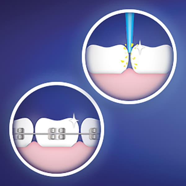 Set 2 Rezerve periuta de dinti electrica ORAL-B Ortho Care + Interspace, 3buc