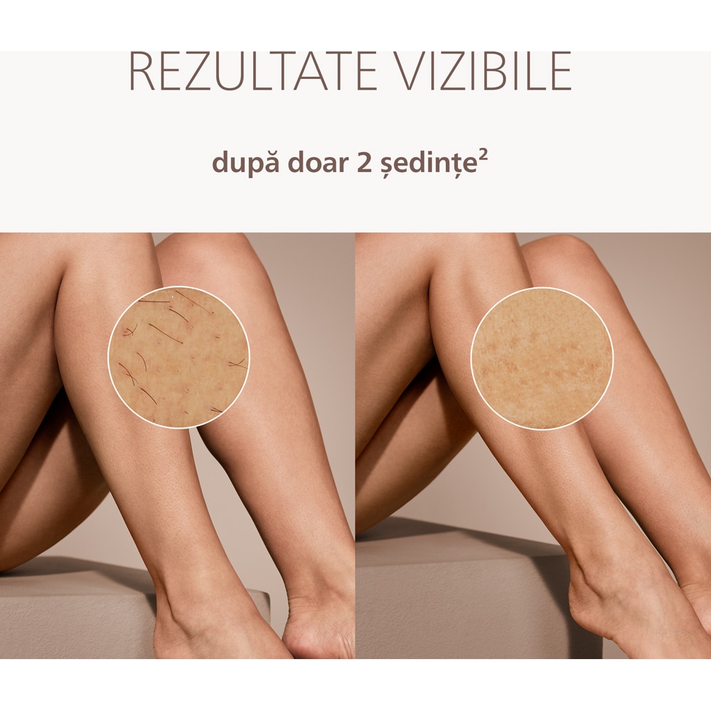 Epilator IPL PHILIPS Lumea 8000 BRI934/00, 500.000 de impulsuri, 2 accesorii, roz