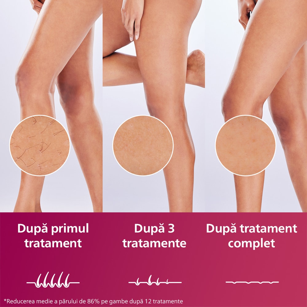 Epilator IPL PHILIPS Lumea Prestige Seria 8000 BRI947/00, 450.000 de impulsuri, 4 accesorii, senzor SmartSkin, retea, argintiu