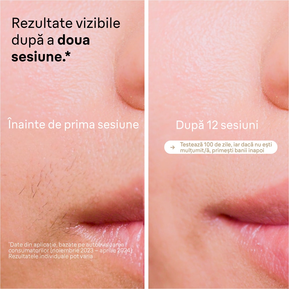 Epilator IPL BRAUN Silk-expert Pro 5 PL5242, 400000 impulsuri, 10 viteze, 4 accesorii, SkinPro 2.0, reatea, alb-auriu