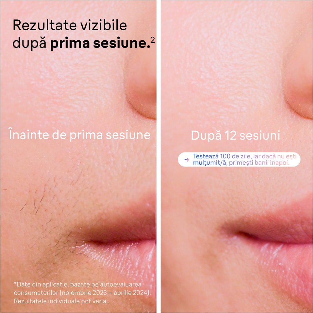 Epilator IPL BRAUN Skin i-Expert Pro 7 PL7147, 400000 impulsuri, 10 viteze, 3 accesorii, SkinPro 2.0, reatea, alb-bronz