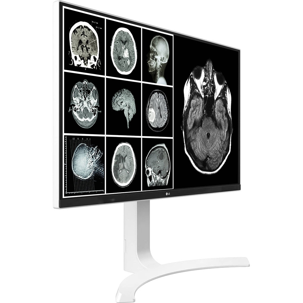 Monitor medical profesional, LED IPS, LG 27HJ712C-W, 27", 4K 8MP, 60Hz, Brightness Stabilization, alb