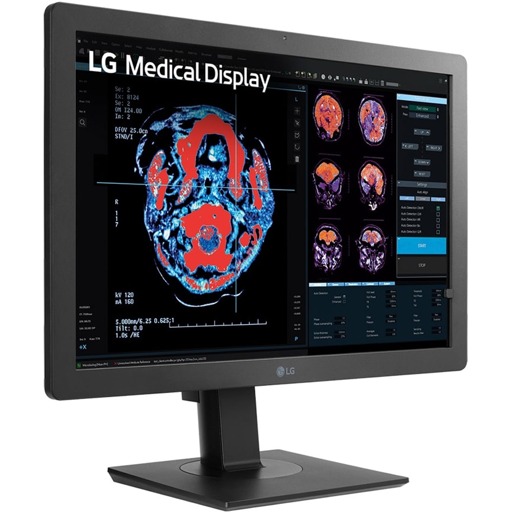 Monitor medical profesional LED IPS LG 24HR513C-B, 24", Full HD, 60Hz, Brightness Stabilization, negru