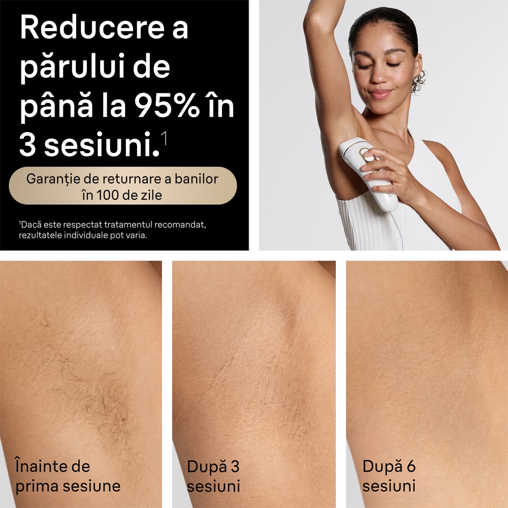Epilator IPL BRAUN Silk-Expert PRO 5 PL5210, 400000 impulsuri, 10 viteze, 2 ccesorii, retea, alb