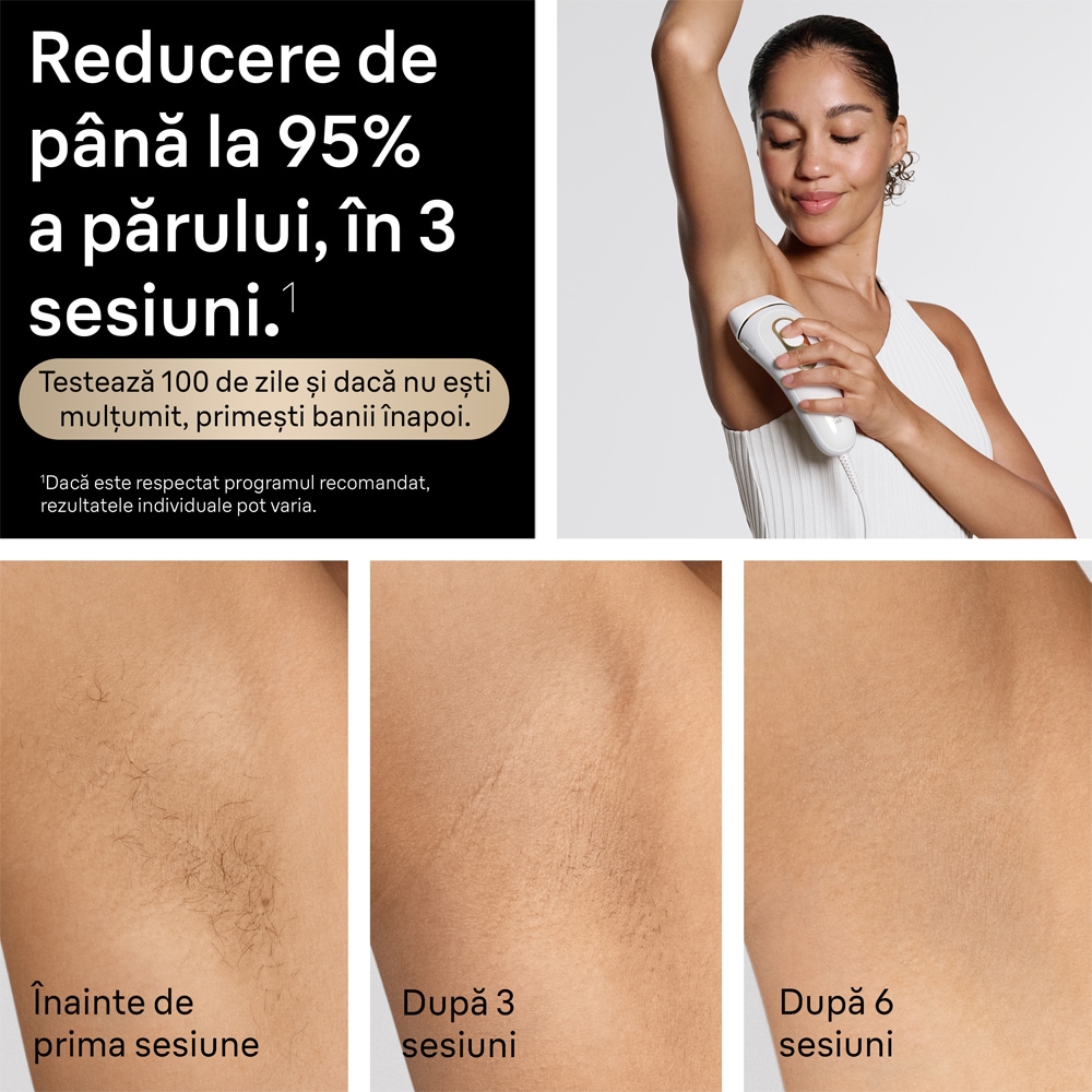 Epilator IPL BRAUN Silk-Expert Pro 5 PL5351, 400000 impulsuri, 10 viteze, 3 accesorii, retea, alb