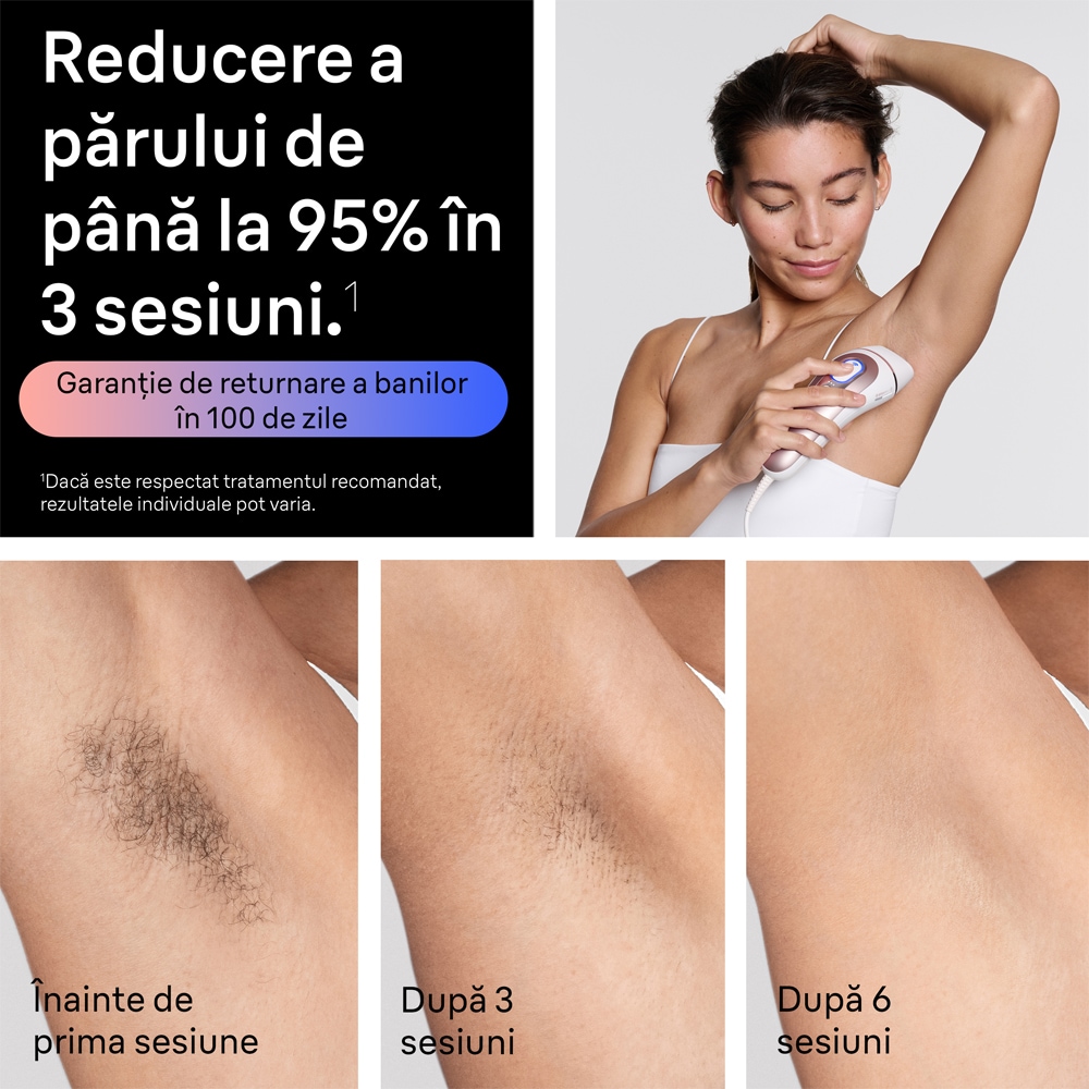 Epilator IPL BRAUN Skin Expert PRO 7 PL7321, 400000 de impulsuri, 3 accesorii, alb