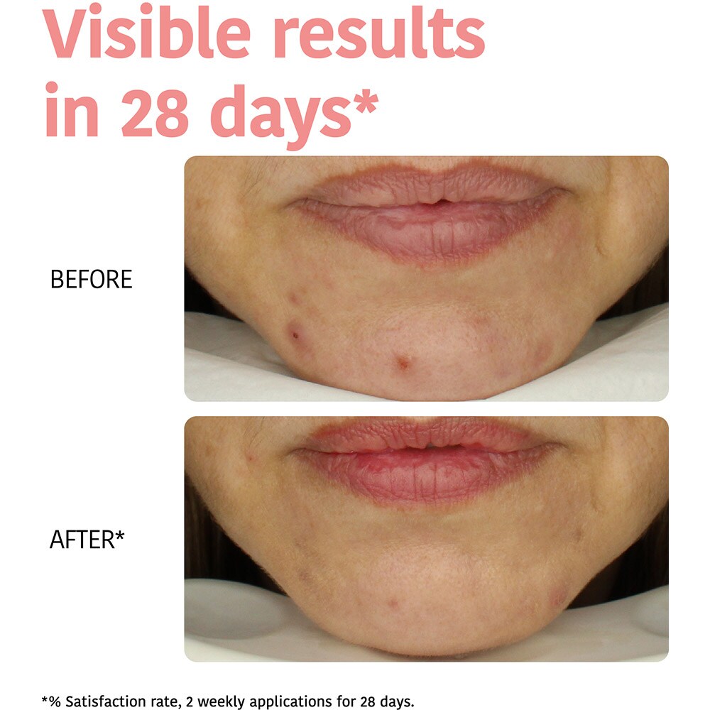 Masca de fata IROHA Glycolic Acid, 1 x 23ml