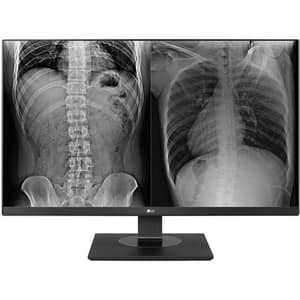 Monitor medical profesional LED IPS LG 27HJ713C-B, 27", 4K 8MP, 60Hz, Brightness Stabilization, negru